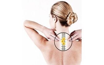 nyaki osteochondrosis egy nőben